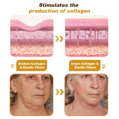 Botox Bee Venom Wrinkle Removal Cream